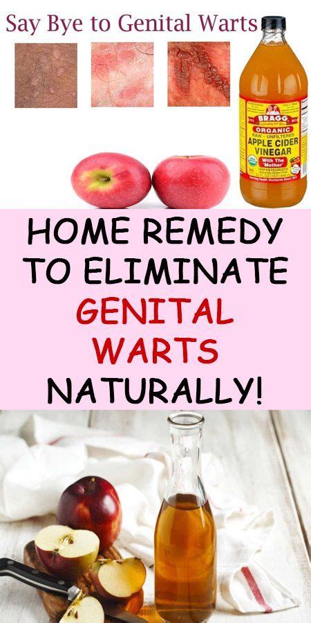 Genital Warts Genital Warts Symptoms Treatments And More | The Best ...