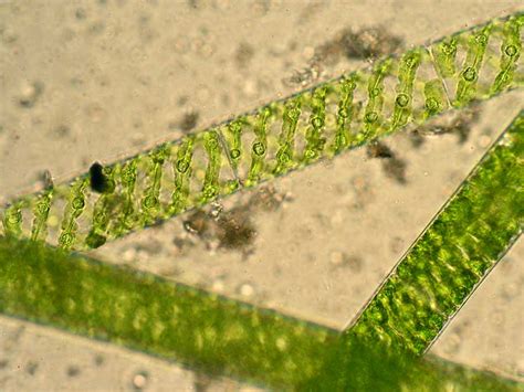 Spirogyra: Structure & Characteristics with Labeled Diagram