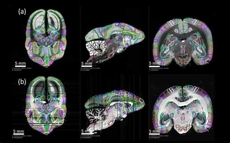 Detailed new primate brain atlas could lead to disease insights