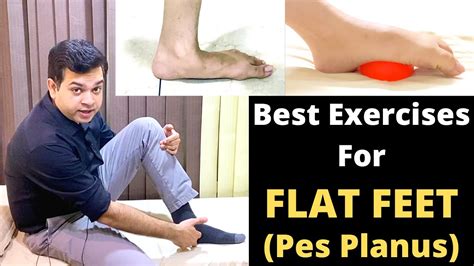 Treatment For Flat Feet, Pes Planus, Flat Foot Exercises, Foot Pain ...