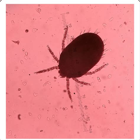 Chigger of a trombiculid mite under microscope on a 1 mm scale ...