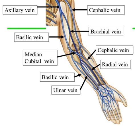 Deep vein thrombosis arm - globalmumu