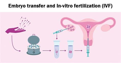 Embryo Transfer- Definition, Process, Types, Condition