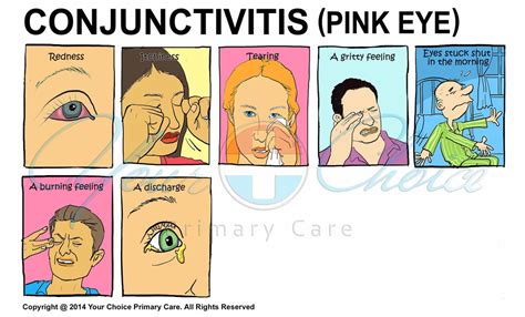 Causes For Pink Eye In Adults - priorityfunny