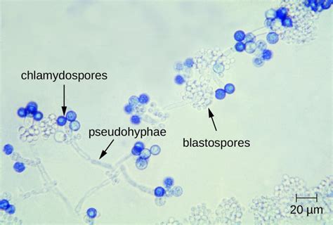 Fungal Infections of the Reproductive System | Microbiology