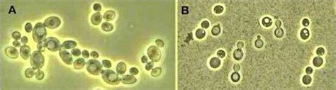 Yeasts