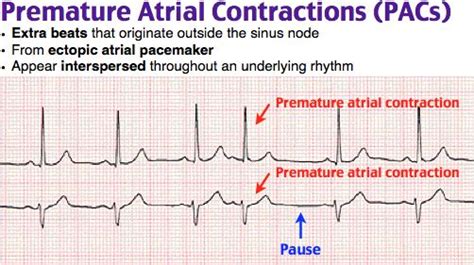 「Cardiology」のおすすめ画像 118 件 | Pinterest | 心臓病学、救急医療、薬