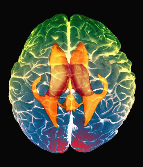 Anatomy Of Ventricles Of Brain