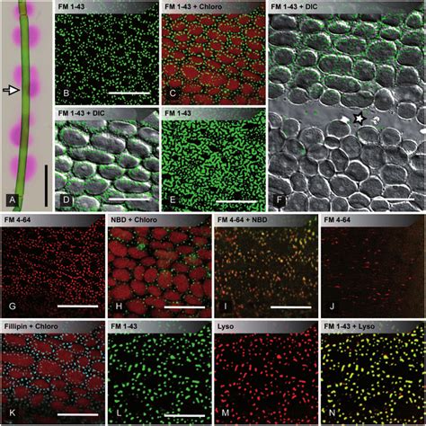 pH banding and accumulation of lipophilic dyes in plasma membrane ...