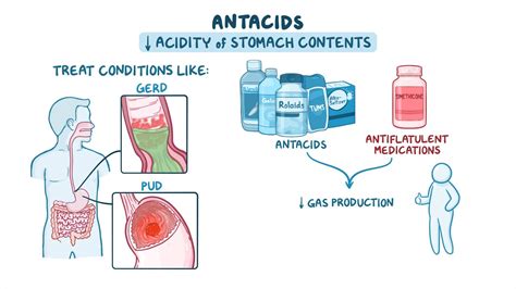 Antacids: Nursing pharmacology - Osmosis Video Library