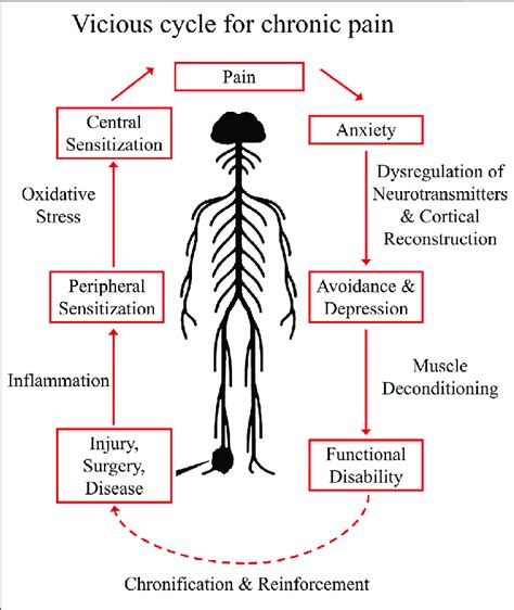 | Vicious Cycle for Chronic Pain Establishment. The establishment of ...