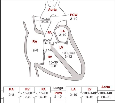 Swan-Ganz catheter & PCWP - Cardiac Nursing - allnurses