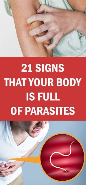 21 Signs That Your Body is Full of Parasites | mooseteaparty