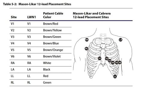 [DIAGRAM] Ecg Lead Placement Guide Diagram - MYDIAGRAM.ONLINE