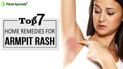 Top 7 Home Remedies for Armpit Rash