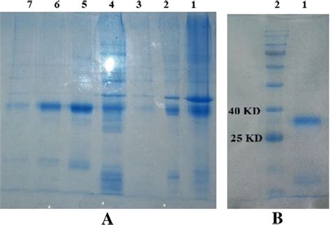 Showing the SDS-PAGE gel electrophoresis representing the purified ...