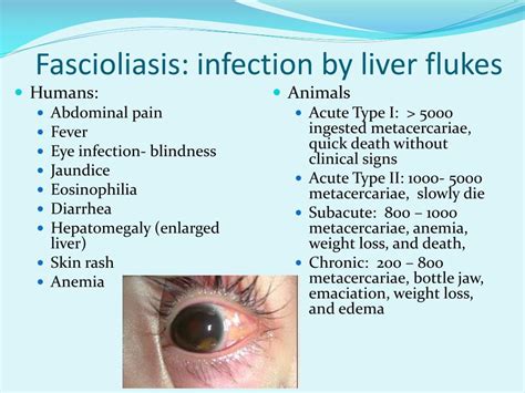 PPT - Fasciola hepatica PowerPoint Presentation, free download - ID:518934