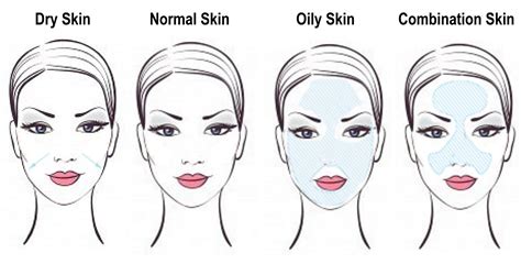 Skin Types