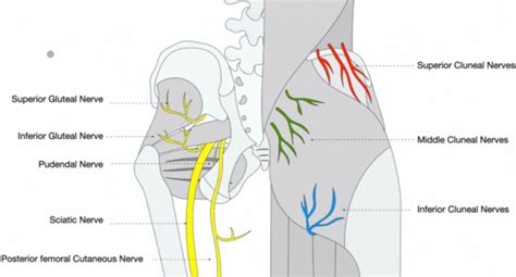 Our Cluneal Nerve Treatment Continues to Help People With Chronic Low ...