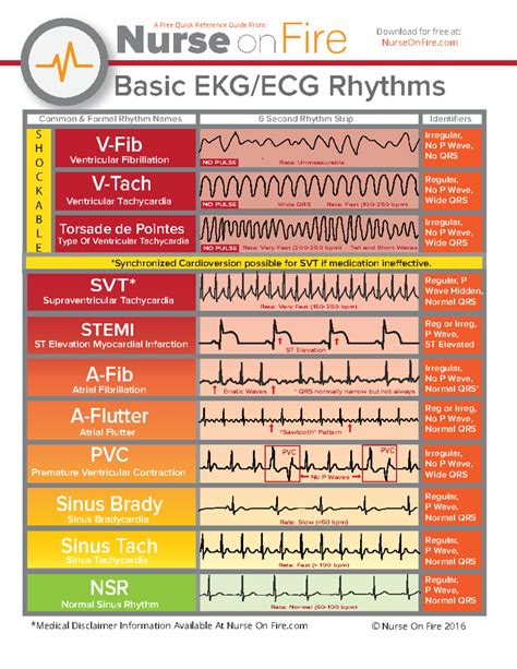 Basic EKG ECG Rhythms Cheatsheet - Copy - Basic EKG/ECG Rhythms V-Fib V ...