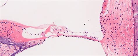 Otic Histopathology – Turner Scientific