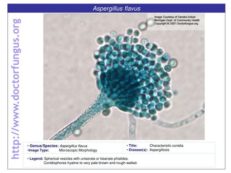 PPT - Aspergillus flavus PowerPoint Presentation, free download - ID ...