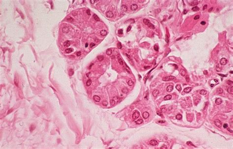 Basic Histology -- Eccrine Sweat Glands