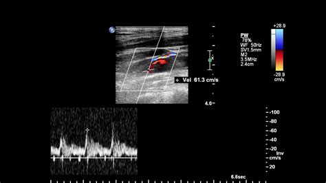 Vascular Ultrasound - Dr. Shamim Lotfi — Lotfi Vascular