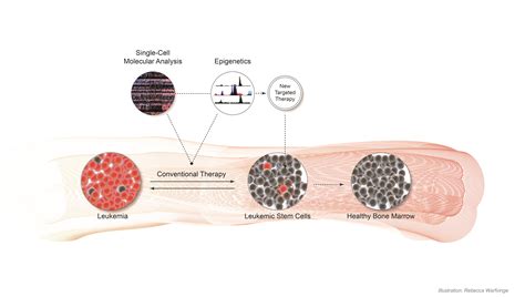 Stem Cells and Leukemia - - Lund University