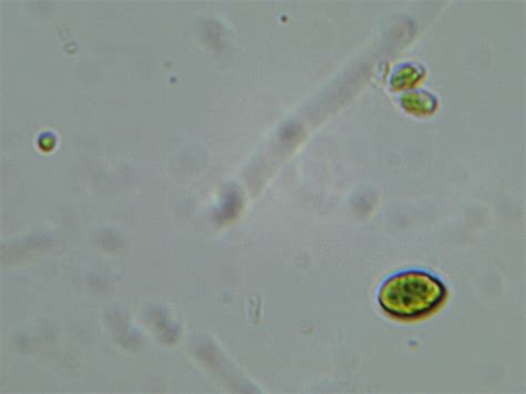 Amateur Algae culturing and cultivation : Ankistrodesmus acicularis for ...