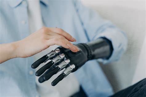 Man With Amputated Arm Gets Bionic Hand in Surgical Breakthrough - Newsweek