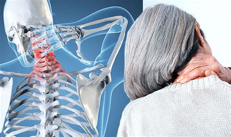 Arthritis: What are the symptoms you need to look for to identify neck ...