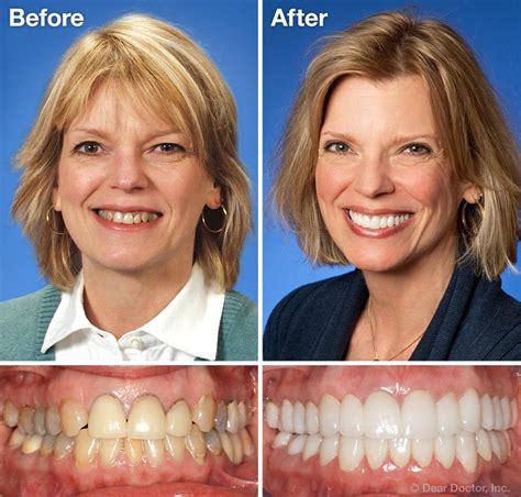 Cosmetic Dentistry | Stanley R. Beard, D.M.D., FAGD | Jackson Alabama