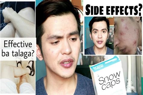 Side Effects of Glutathione Skin Whitening Injections - Health Explanation