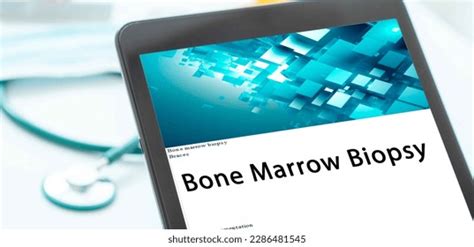 Bone Marrow Biopsy Medical Procedures Procedure Stock Photo 2286481545 ...