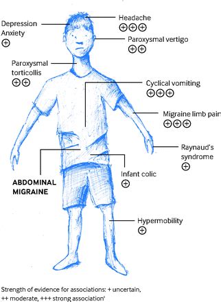 Abdominal Migraine In Adults - change comin