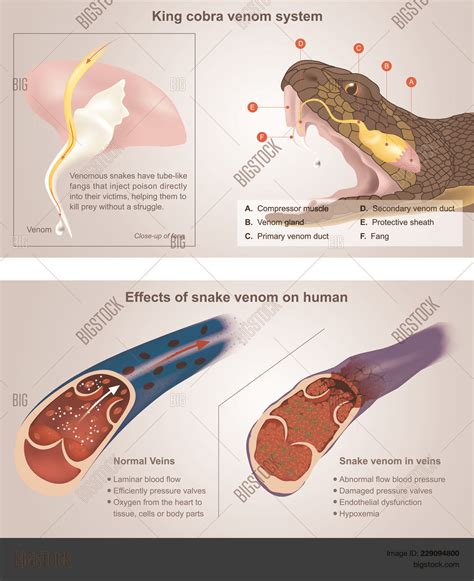 King Cobra Venom Vector & Photo (Free Trial) | Bigstock