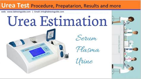 Urea Test Procedure | Lab Tests Guide