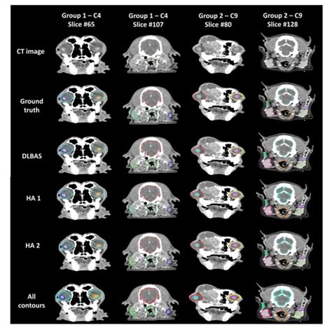 | Measurement of the cephalic index. For measuring the cephalic index ...