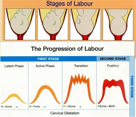 My Rhythm of Life: Understanding the Stages of Labour is Laborious