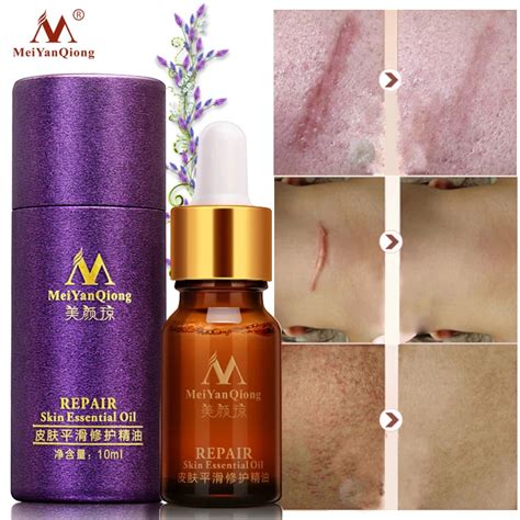 Scar Repair Skin Essential Oil Lavender Essence Skin Care Natural Pure ...