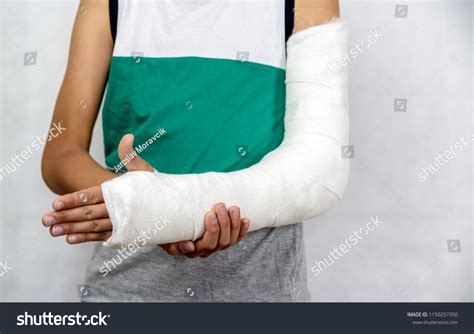 Boy Broken Hand Cast Stock Photo 1150257350 | Shutterstock