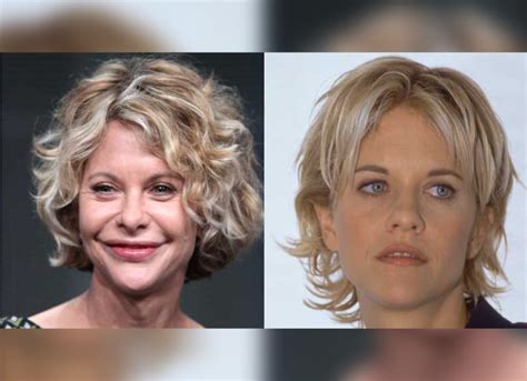 Meg Ryan Plastic Surgery: Ryan Destroyed Her Face With Botox And ...