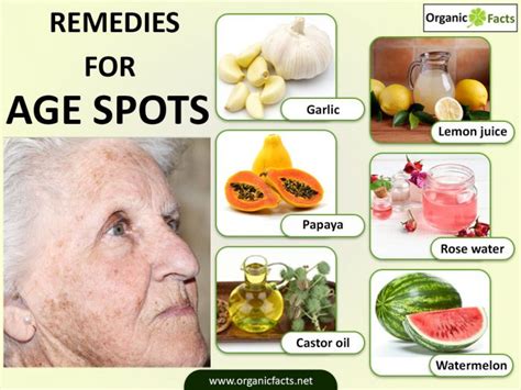 Age Spots: Treatments & Home Remedies | Organic Facts