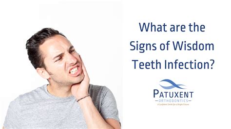 What are the Signs of Wisdom Teeth Infection?