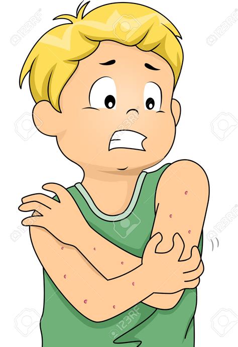 Allergic reaction clipart - Clipground