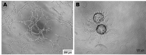 Endothelial cells ability to angiogenesis in vitro. (A)-Tube Formation ...