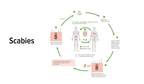 Scabies: Symptoms, Causes, Treatment, and Prevention - FemX