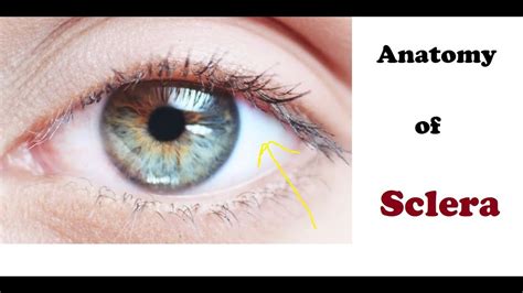 Sclera Of The Eye Abnormalities