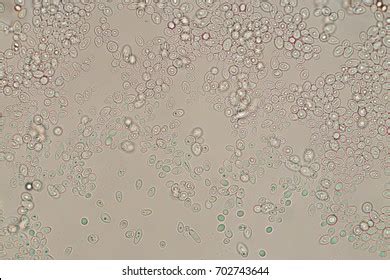 Blastospore Images, Stock Photos & Vectors | Shutterstock